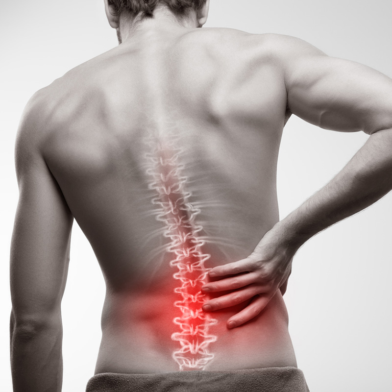 Ryggskott, ischias, diskbråck, foglossning